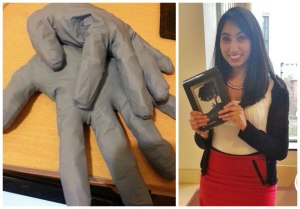 The Dental Gloves and the winner